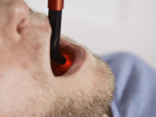 Energy-Laser L500 Pro Lasertherapie gerät