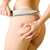 Körperformende Behandlung