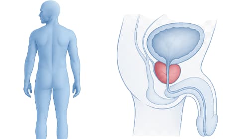Penisrehabilitation nach Prostataoperation – Vakuum‑Trainingsprotokoll