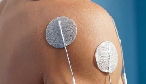 Formen der elektrischen Muskelstimulation (EMS)