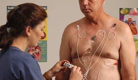 Informationen zur Holter‑EKG‑Untersuchung