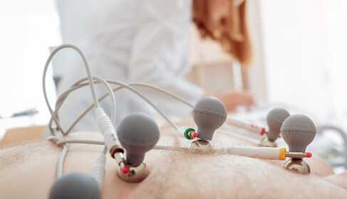 EKG – was man über die elektrokardiographische Untersuchung wissen muss