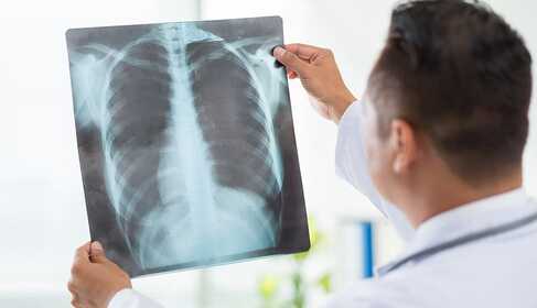 Rehabilitation nach einer Covid-19-Infektion