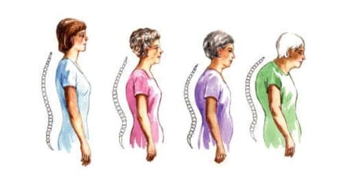 Osteoporose und Magnettherapie – Ergänzende Behandlung zu Hause