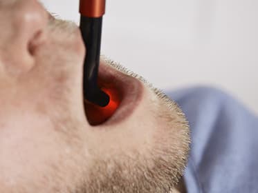 Softlaser in der Zahnmedizin: Behandlung von Mundbeschwerden zu Hause