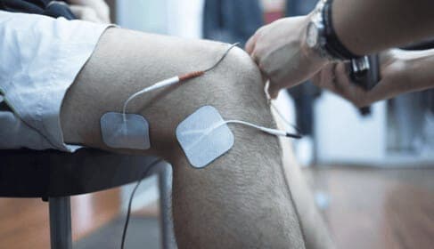 Mikrostrombehandlung in der Praxis
