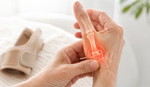 Sattelgelenksarthrose zu Hause behandeln