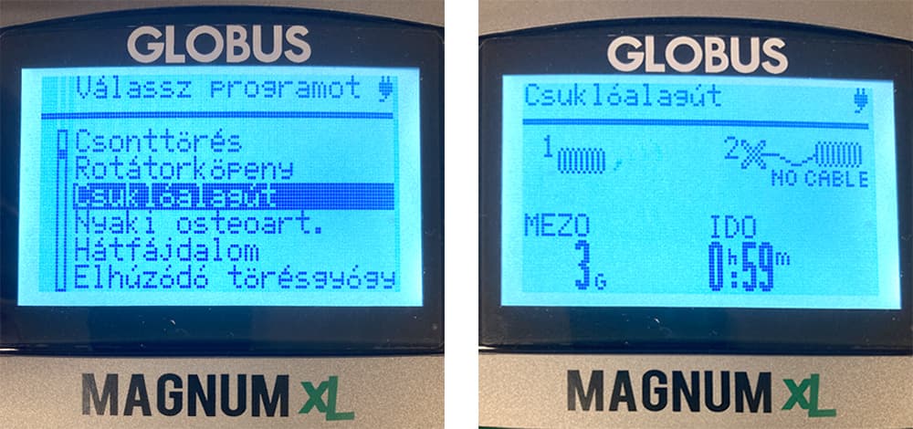 PEMF-Behandlung Karpaltunnelsyndrom - Programmauswahl