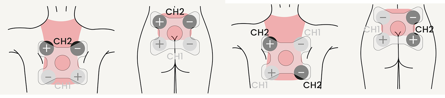 Back-pain-electrode.png