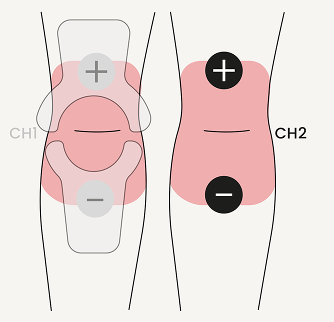 Knee-pain-electrode.png